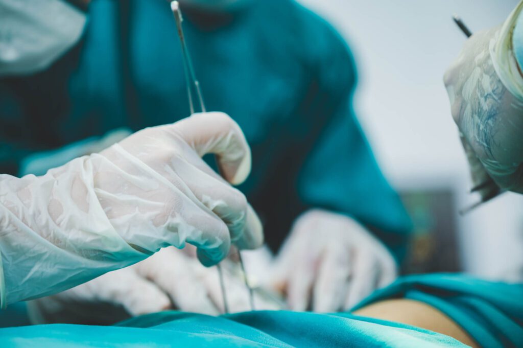 Tratamiento de implantes de pene en Miami