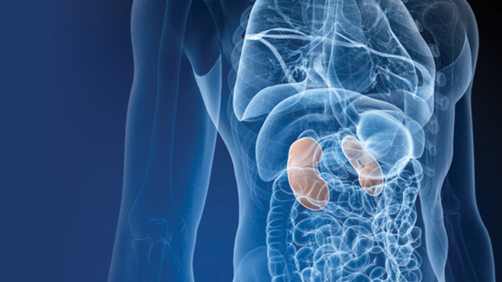Especialista en carcinoma urotelial del tracto superior en Miami