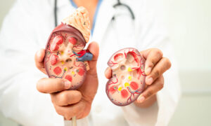 Signos tempranos de cáncer de riñón que la mayoría de los pacientes pasan por alto