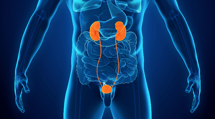 Upper Tract Urothelial Carcinoma Specialist Miami