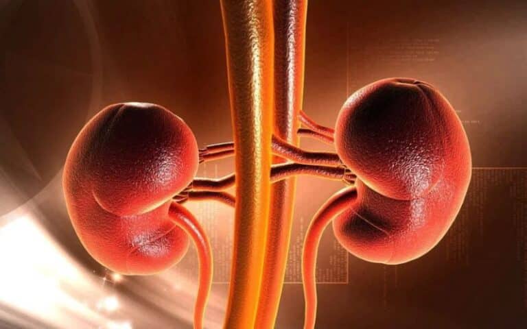 Life After Kidney Stone Surgery: Tips for a Smooth Recovery