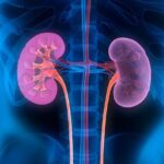 Recovery Timeline After Robotic Kidney Cancer Surgery